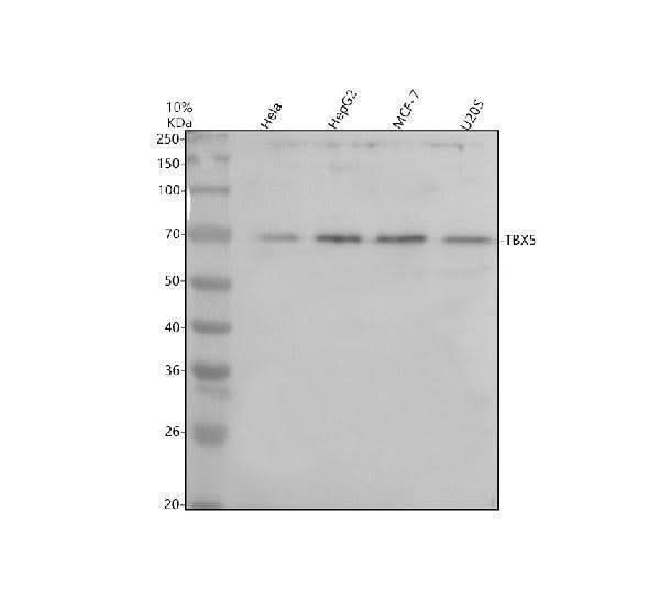Anti-TBX5 Antibody Picoband® Boster Bio