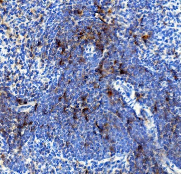 Anti-IL4R Antibody Boster Bio