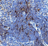 Anti-IL4R Antibody Boster Bio
