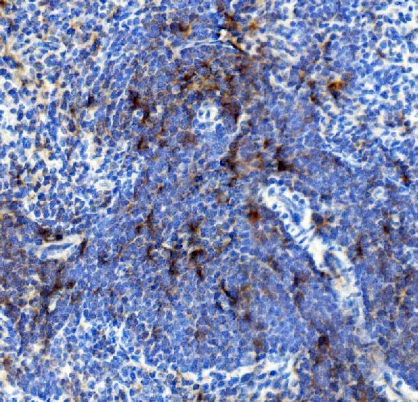 Anti-IL4R Antibody Boster Bio