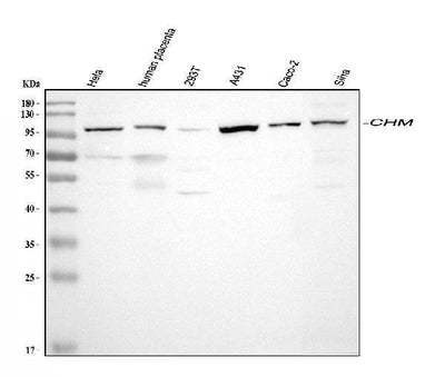 Anti-CHM Antibody Picoband® Boster Bio