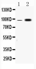 Anti-Fibrinogen alpha chain/FGA Antibody Picoband® Boster Bio