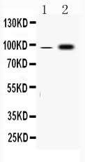 Anti-Fibrinogen alpha chain/FGA Antibody Picoband® Boster Bio