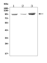 Anti-Fibrinogen alpha chain/FGA Antibody Picoband® Boster Bio