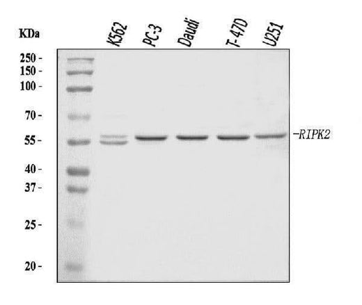 Anti-RIP2/RIPK2 Antibody Picoband® Boster Bio