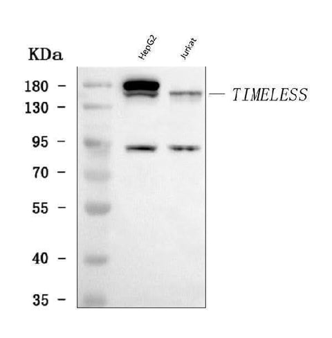 Anti-TIMELESS Antibody Picoband® Boster Bio
