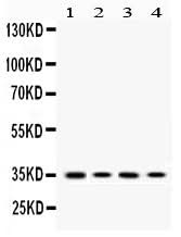 Anti-MC1 Receptor/MC1R Antibody Picoband® Boster Bio