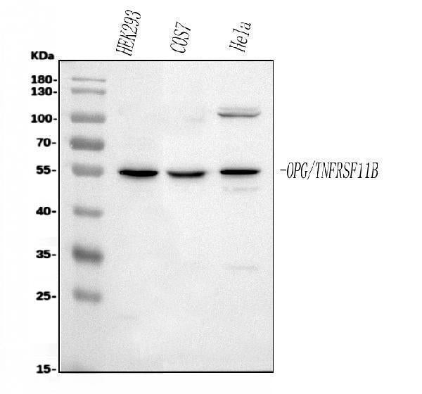Anti-Osteoprotegerin/TNFRSF11B Antibody Picoband® Boster Bio