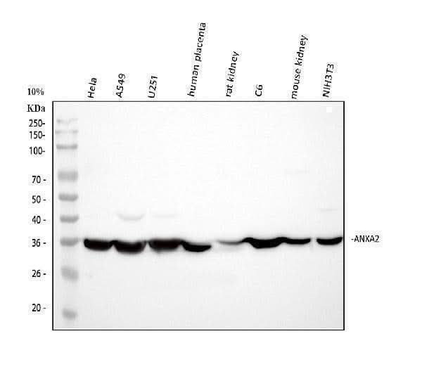 Anti-Annexin A2/ANXA2 Antibody Picoband® Boster Bio