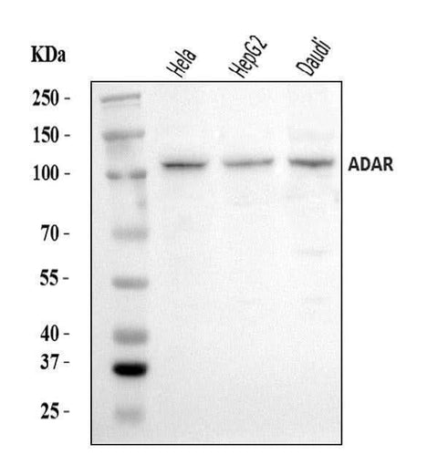 Anti-ADAR1/ADAR Antibody Picoband® Boster Bio