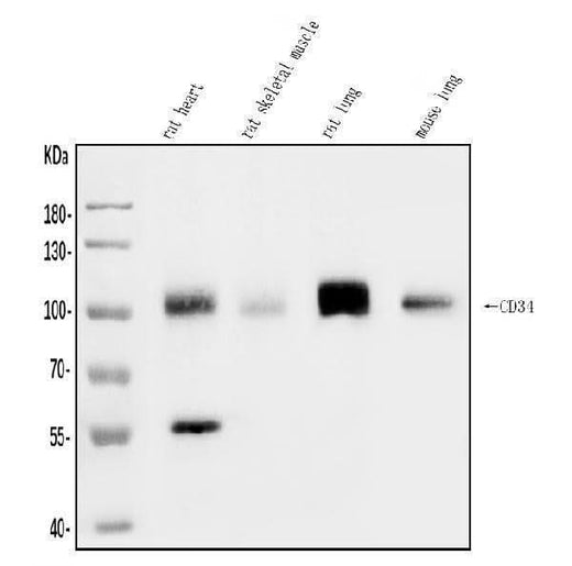 Anti-CD34 Antibody Picoband® Boster Bio