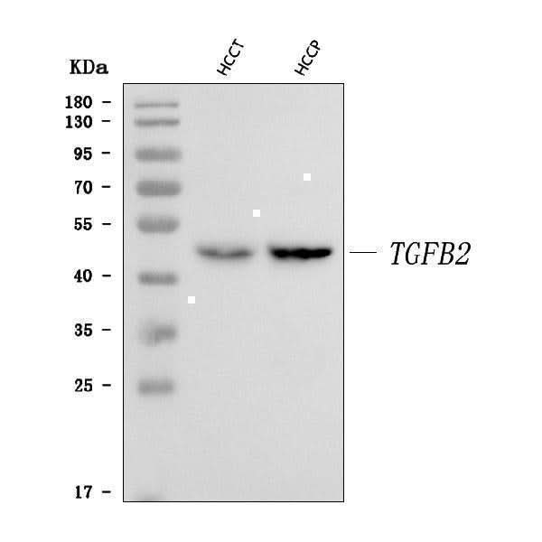 Anti-TGF beta 2/TGFB2 Antibody Picoband® Boster Bio