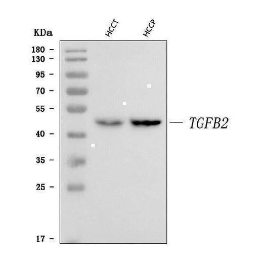 Anti-TGF beta 2/TGFB2 Antibody Picoband® Boster Bio