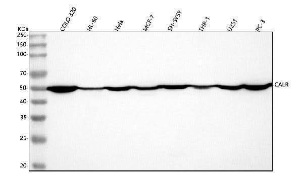 Anti-Calreticulin/CALR Antibody Picoband® Boster Bio