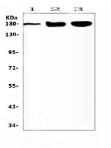 Anti-SUR1/ABCC8 Antibody Picoband® Boster Bio