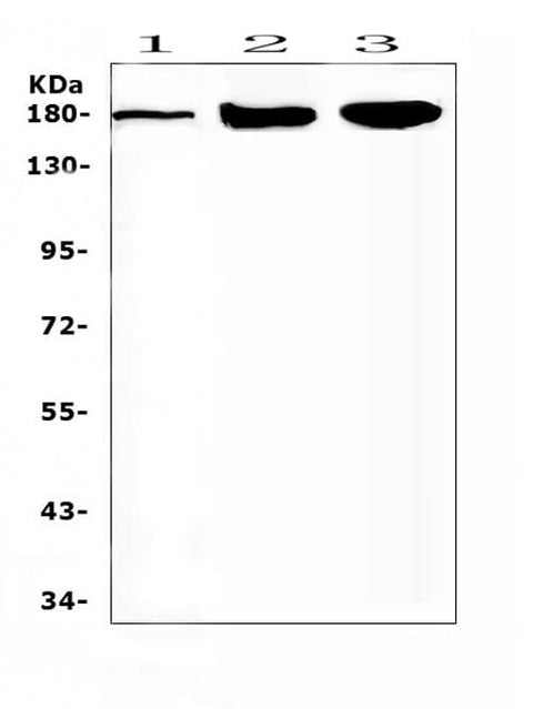 Anti-SUR1/ABCC8 Antibody Picoband® Boster Bio