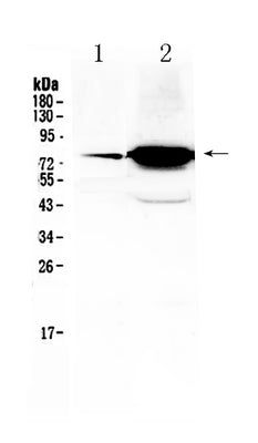 Anti-FSH Receptor/FSHR Antibody Picoband® Boster Bio