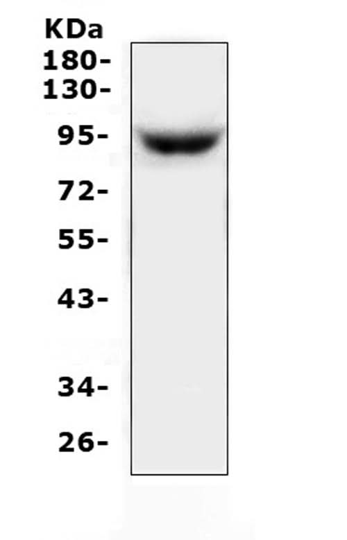 Anti-MAP3K20 Antibody Picoband® Boster Bio