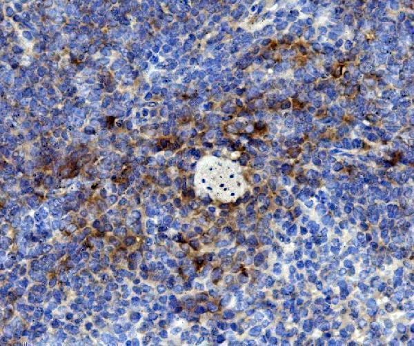 Anti-Cd59 Antibody Boster Bio