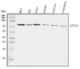 Anti-CPT1A Antibody Picoband® Boster Bio