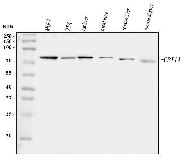 Anti-CPT1A Antibody Picoband® Boster Bio
