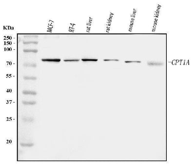 Anti-CPT1A Antibody Picoband® Boster Bio