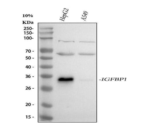 Anti-IGFBP1 Antibody Picoband® Boster Bio