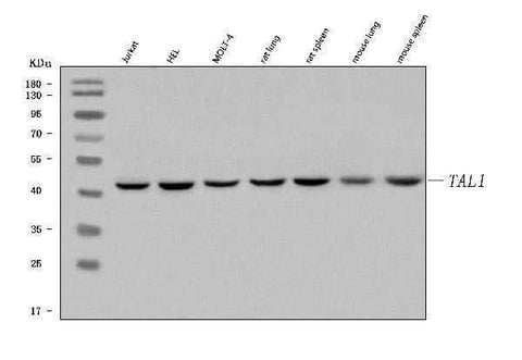 Anti-TAL1 Antibody Picoband® Boster Bio