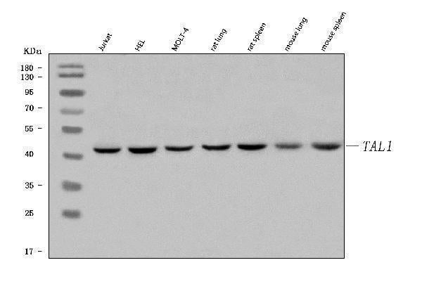Anti-TAL1 Antibody Picoband® Boster Bio
