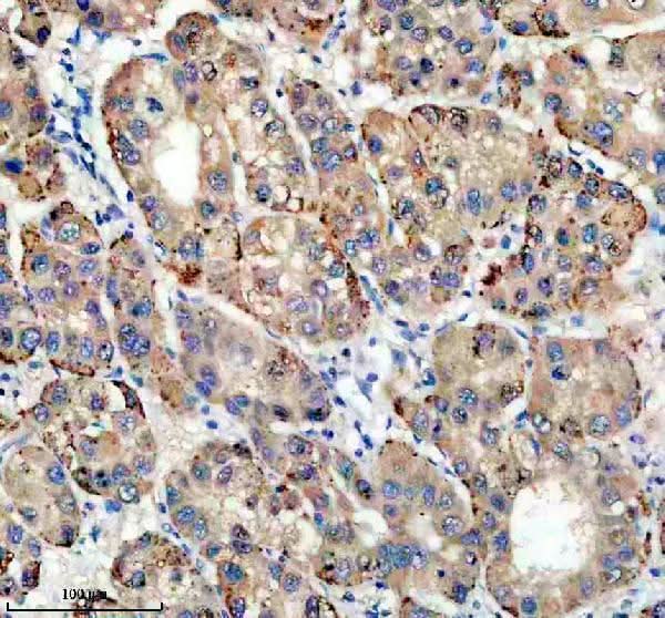 Anti-TIRAP Antibody Boster Bio