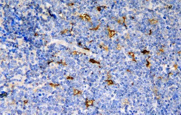 Anti-CCR6 Antibody Boster Bio