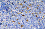 Anti-CCR6 Antibody Boster Bio