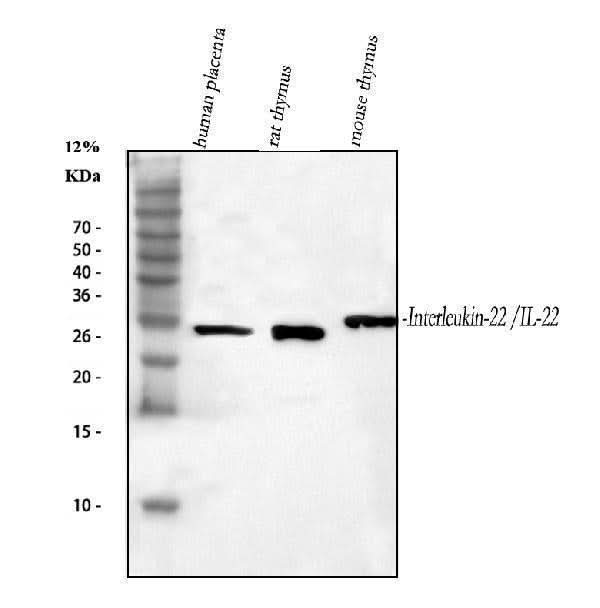Anti-IL-22/IL22 Antibody Picoband® Boster Bio