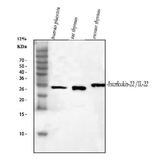 Anti-IL-22/IL22 Antibody Picoband® Boster Bio