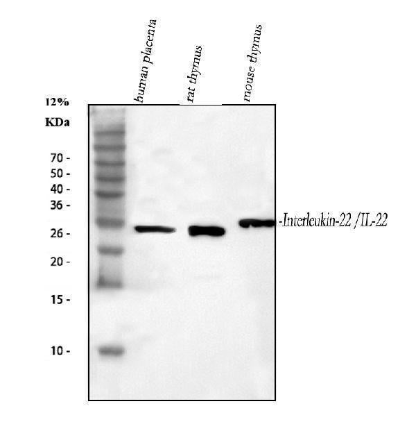 Anti-IL-22/IL22 Antibody Picoband® Boster Bio
