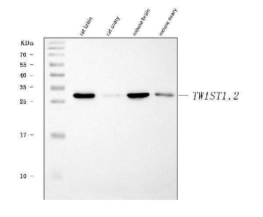 Anti-TWIST1/2 Antibody Picoband® Boster Bio
