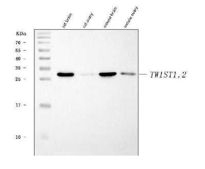 Anti-TWIST1/2 Antibody Picoband® Boster Bio