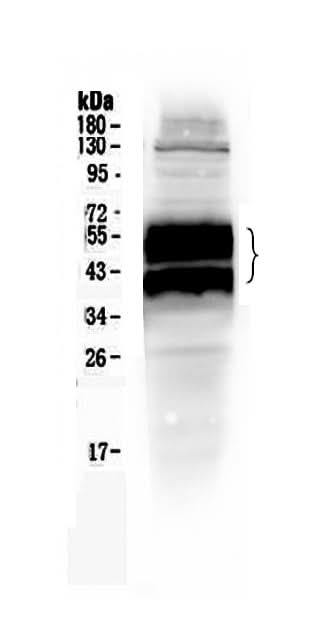 Anti-uPA Receptor/PLAUR Antibody Picoband® Boster Bio