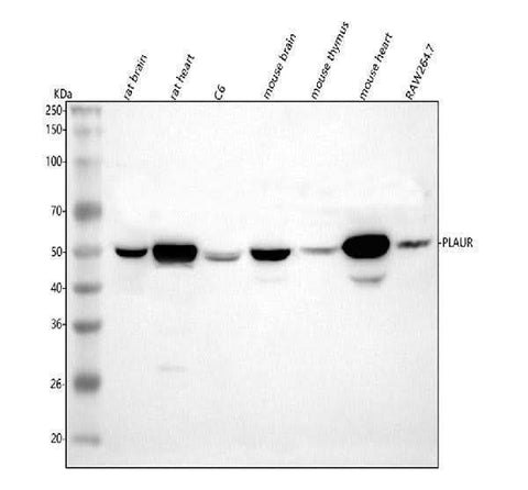 Anti-uPA Receptor/Plaur Antibody Picoband® Boster Bio