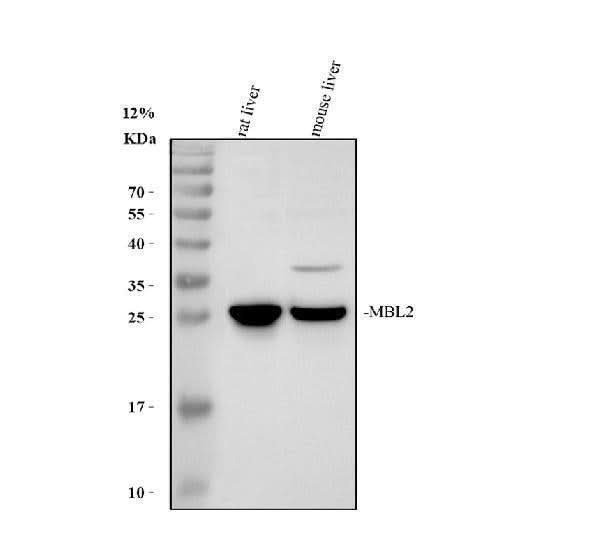 Anti-MBL2 Antibody Picoband® Boster Bio