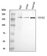 Anti-TRPM2 Antibody Picoband® Boster Bio