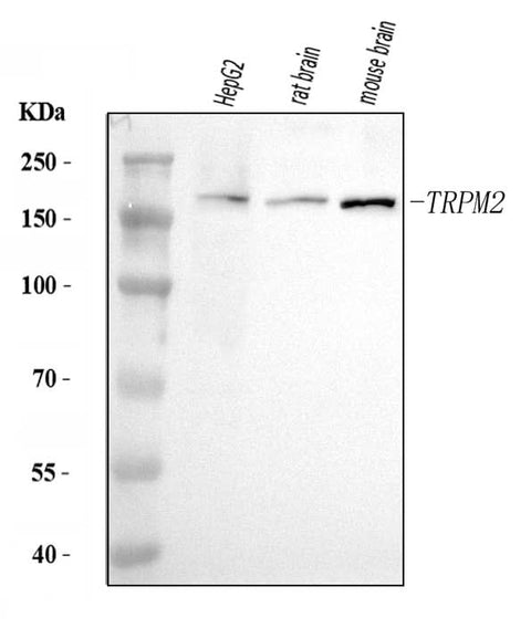 Anti-TRPM2 Antibody Picoband® Boster Bio