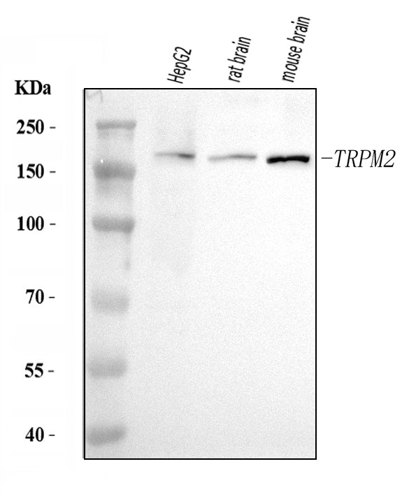 Anti-TRPM2 Antibody Picoband® Boster Bio