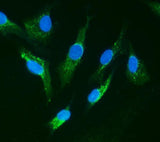 Anti-IRAK/IRAK1 Antibody Picoband® Boster Bio