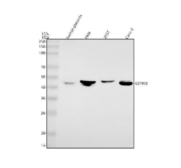 Anti-EDNRB Antibody Picoband® Boster Bio