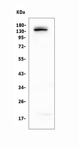 Anti-LATS1 Antibody Picoband® Boster Bio