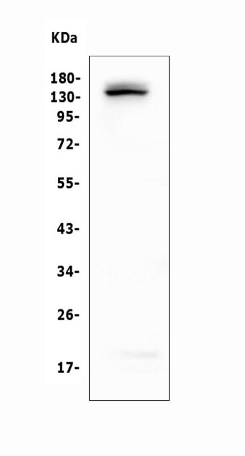 Anti-LATS1 Antibody Picoband® Boster Bio