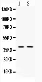 Anti-Doublecortin/DCX Antibody Picoband® Boster Bio