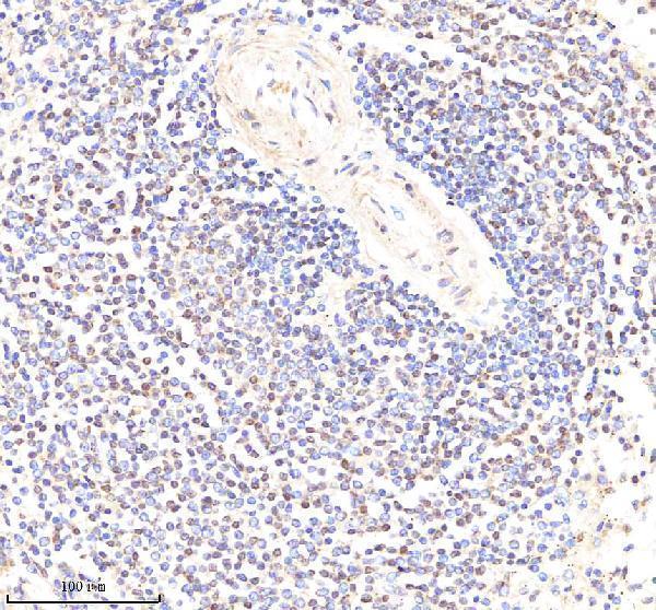 Anti-PYK2/PTK2B Antibody Picoband® Boster Bio