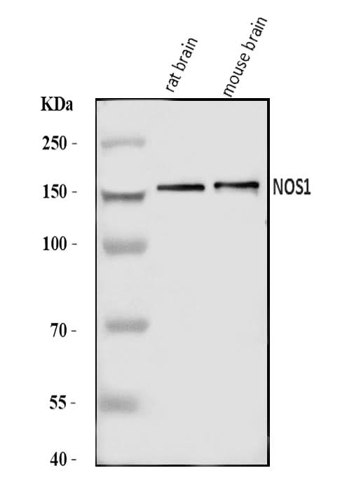 Anti-nNOS (neuronal)/NOS1 Antibody Picoband® Boster Bio